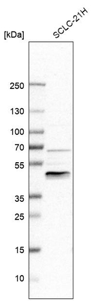 ZNF24 Antibody in Western Blot (WB)