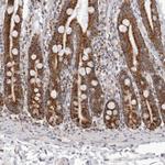 TUFM Antibody in Immunohistochemistry (Paraffin) (IHC (P))