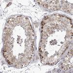 TUFM Antibody in Immunohistochemistry (Paraffin) (IHC (P))