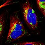 ETFA Polyclonal Antibody