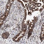 ETFA Antibody in Immunohistochemistry (Paraffin) (IHC (P))