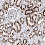 ETFA Antibody in Immunohistochemistry (Paraffin) (IHC (P))
