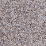 ETFA Antibody in Immunohistochemistry (Paraffin) (IHC (P))