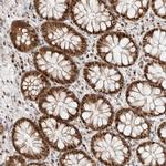 TSPAN32 Antibody in Immunohistochemistry (Paraffin) (IHC (P))