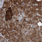 USP25 Antibody in Immunohistochemistry (Paraffin) (IHC (P))