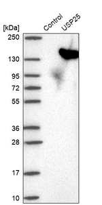 USP25 Antibody in Western Blot (WB)