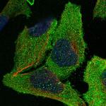 eIF2b gamma Polyclonal Antibody