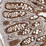 eIF2b gamma Antibody in Immunohistochemistry (Paraffin) (IHC (P))