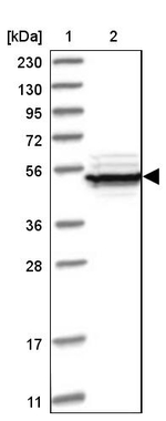 eIF2b gamma Antibody in Western Blot (WB)
