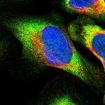 eIF2b gamma Polyclonal Antibody