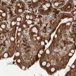 eIF2b gamma Antibody in Immunohistochemistry (Paraffin) (IHC (P))