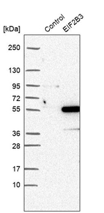 eIF2b gamma Antibody in Western Blot (WB)