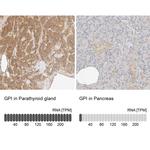 GPI Antibody