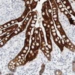 Cytokeratin 20 Antibody in Immunohistochemistry (Paraffin) (IHC (P))