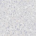 Cytokeratin 20 Antibody in Immunohistochemistry (Paraffin) (IHC (P))