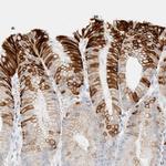 Cytokeratin 20 Polyclonal Antibody