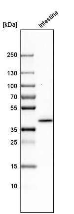 Cytokeratin 20 Antibody in Western Blot (WB)