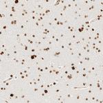 ZNF447 Polyclonal Antibody