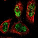 PRDM4 Antibody in Immunocytochemistry (ICC/IF)