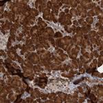 PRDM4 Antibody in Immunohistochemistry (Paraffin) (IHC (P))