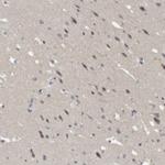 NFATC2 Polyclonal Antibody