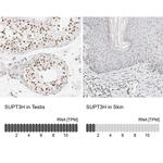 SPT3 Antibody