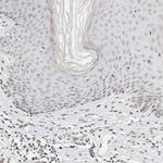 SPT3 Antibody in Immunohistochemistry (Paraffin) (IHC (P))