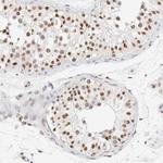 SPT3 Antibody in Immunohistochemistry (Paraffin) (IHC (P))
