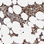 S100A8 Antibody in Immunohistochemistry (Paraffin) (IHC (P))