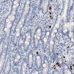 S100A8 Antibody in Immunohistochemistry (Paraffin) (IHC (P))