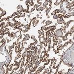 CD55 Antibody in Immunohistochemistry (Paraffin) (IHC (P))