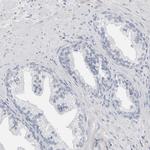 CD55 Antibody in Immunohistochemistry (Paraffin) (IHC (P))