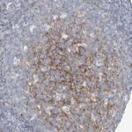 CD55 Polyclonal Antibody