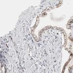 Calpain 2 Antibody in Immunohistochemistry (Paraffin) (IHC (P))