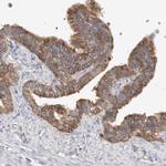 Calpain 2 Antibody in Immunohistochemistry (Paraffin) (IHC (P))