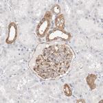 Calpain 2 Antibody in Immunohistochemistry (Paraffin) (IHC (P))