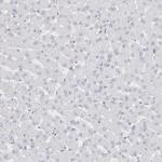 Calpain 2 Antibody in Immunohistochemistry (Paraffin) (IHC (P))