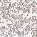 Calpain 2 Antibody in Immunohistochemistry (Paraffin) (IHC (P))