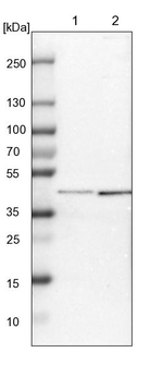 SP6 Antibody in Western Blot (WB)