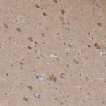 SCRN1 Antibody in Immunohistochemistry (Paraffin) (IHC (P))