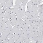 SCRN1 Antibody in Immunohistochemistry (Paraffin) (IHC (P))