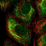 Cytokeratin 15 Polyclonal Antibody