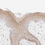 Cytokeratin 15 Antibody in Immunohistochemistry (Paraffin) (IHC (P))