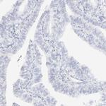 Cytokeratin 15 Antibody in Immunohistochemistry (Paraffin) (IHC (P))