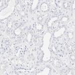 Cytokeratin 15 Antibody in Immunohistochemistry (Paraffin) (IHC (P))