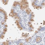 Cytokeratin 15 Antibody in Immunohistochemistry (Paraffin) (IHC (P))