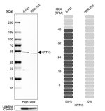 Cytokeratin 15 Antibody in Western Blot (WB)