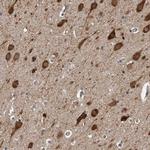 ENY2 Antibody in Immunohistochemistry (Paraffin) (IHC (P))