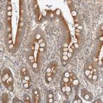 MARK3 Antibody in Immunohistochemistry (Paraffin) (IHC (P))