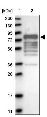 MARK3 Antibody in Western Blot (WB)
